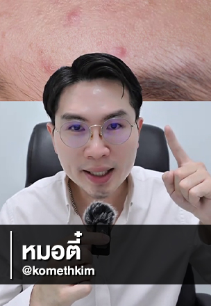 Choosing an Acne Serum? Start with What’s Inside