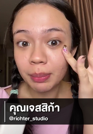 Acne Gone. For Real. You Need to See This Glow-Up!