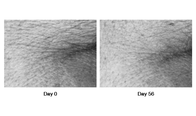 `Real Results`
with Wrinkle Expert M3 Peptide Serum