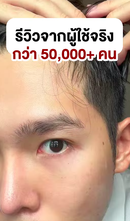 Real Users, One Voice: “This Hair Serum Actually Works!”