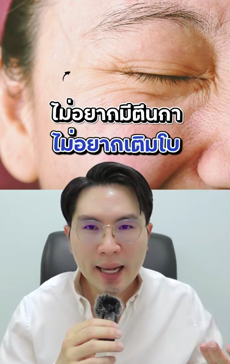 Don’t want crow’s feet? Don’t want Botox injections? 👉 You need to watch this clip!