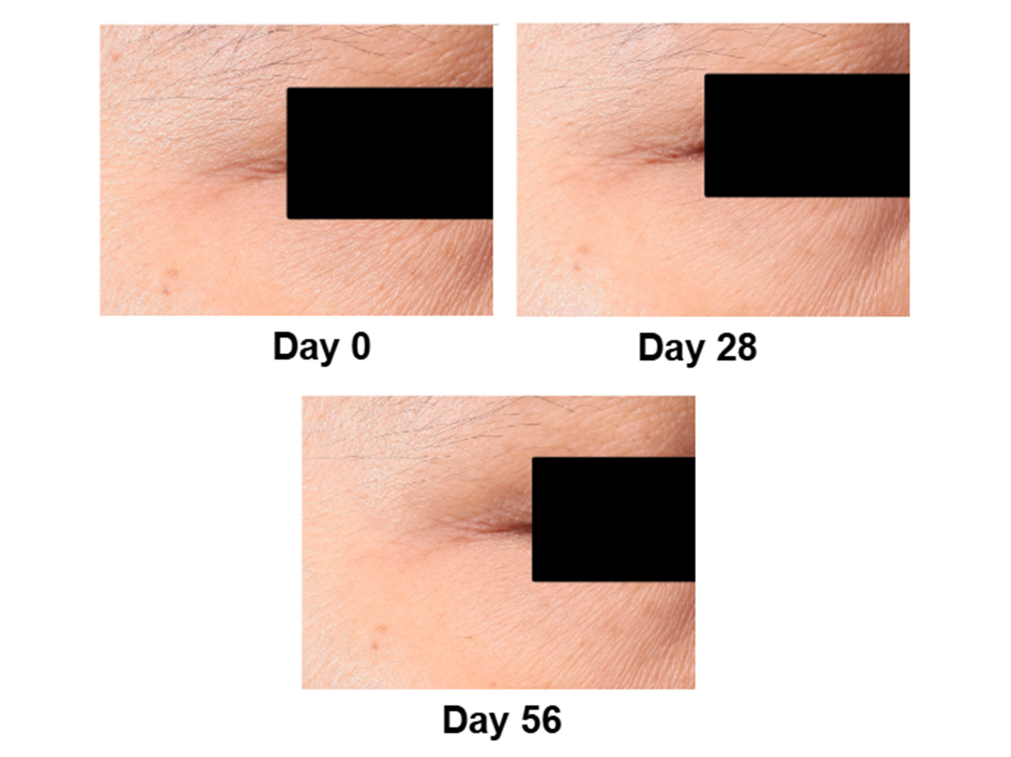 `Real Results`
with Retinol Serum